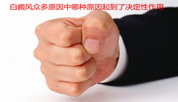 白癜风众多原因中哪种原因起到了决定性作用