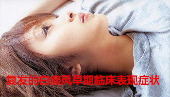 <strong>复发的白癜风早期临床表现症状</strong>