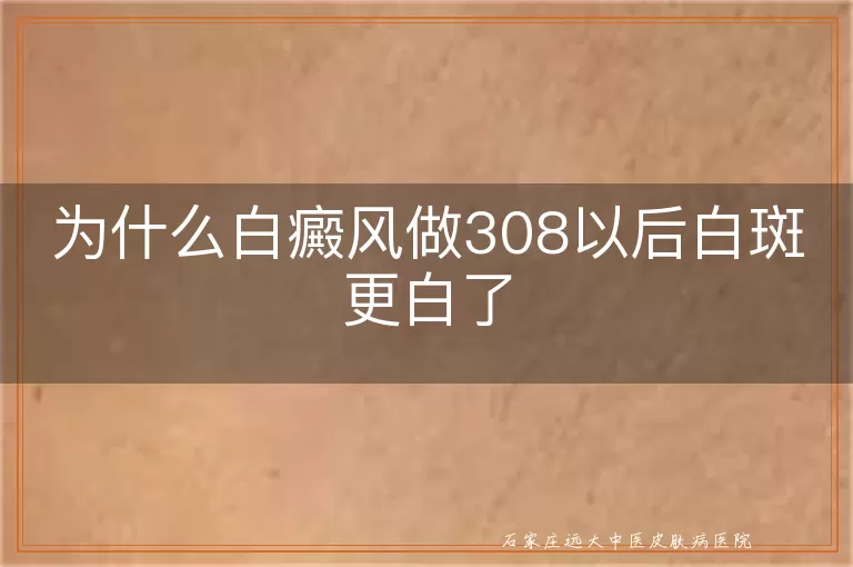 为什么白癜风做308以后白斑更白了