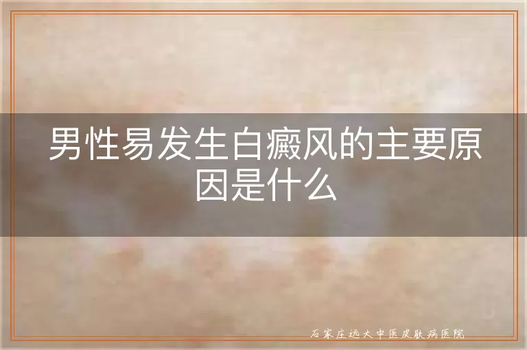 男性易发生白癜风的主要原因是什么