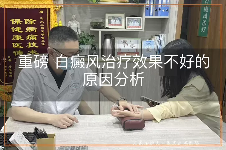 重磅 白癜风治疗效果不好的原因分析