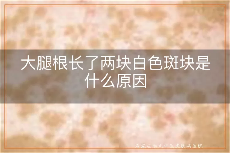 大腿根长了两块白色斑块是什么原因