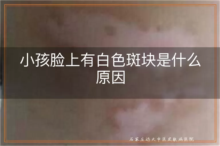小孩脸上有白色斑块是什么原因