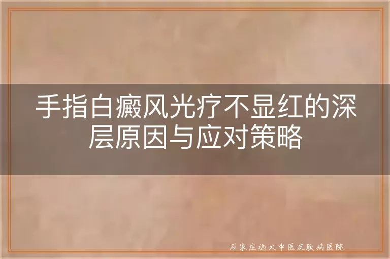 手指白癜风光疗不显红的深层原因与应对策略