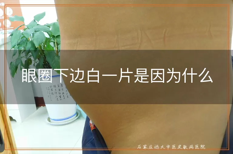 眼圈下边白一片是因为什么