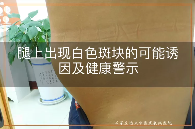 腿上出现白色斑块的可能诱因及健康警示
