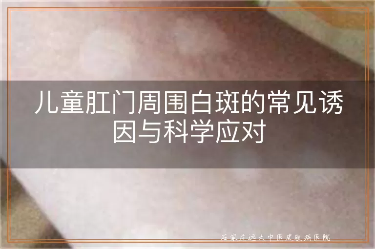 儿童肛门周围白斑的常见诱因与科学应对
