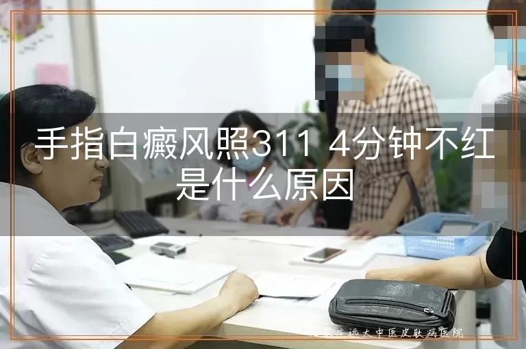 手指白癜风照311 4分钟不红是什么原因