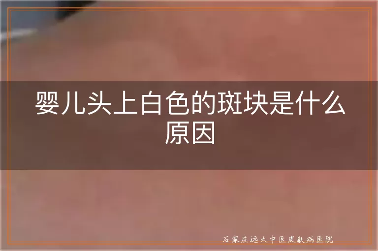 婴儿头上白色的斑块是什么原因