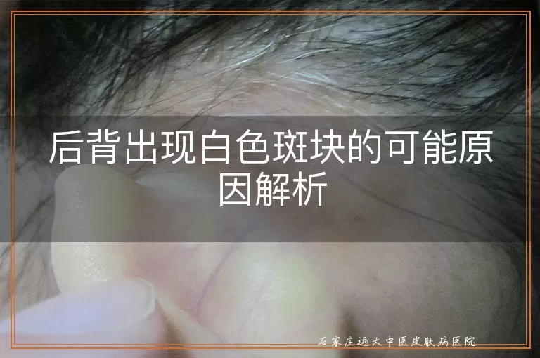 后背出现白色斑块的可能原因解析