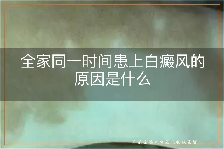 全家同一时间患上白癜风的原因是什么
