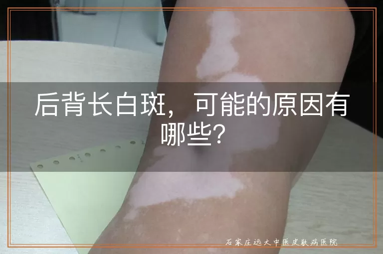 后背长白斑,可能的原因有哪些?
