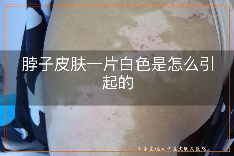 脖子皮肤一片白色是怎么引起的