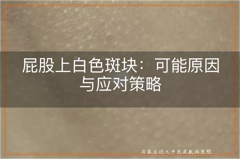 屁股上白色斑块：可能原因与应对策略