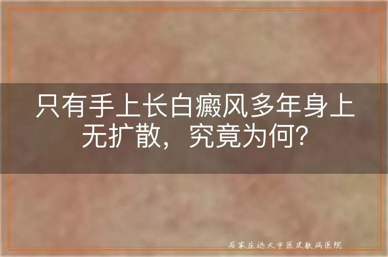 只有手上长白癜风多年身上无扩散，究竟为何？