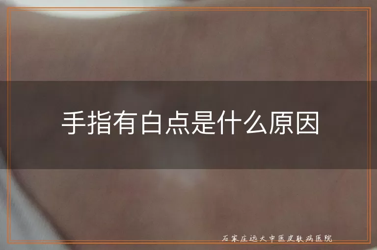 手指有白点是什么原因