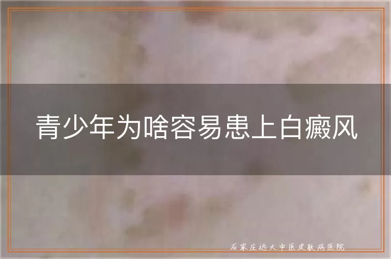 青少年为啥容易患上白癜风