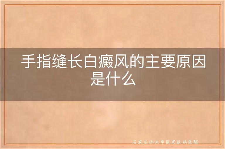 手指缝长白癜风的主要原因是什么