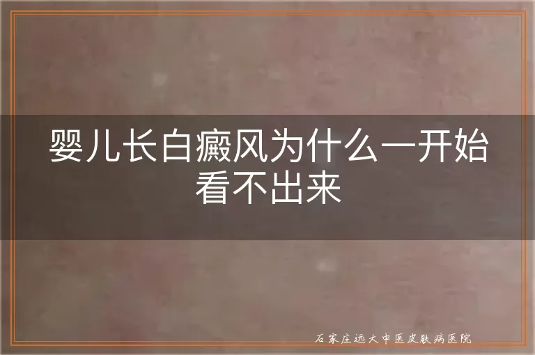 婴儿长白癜风为什么一开始看不出来