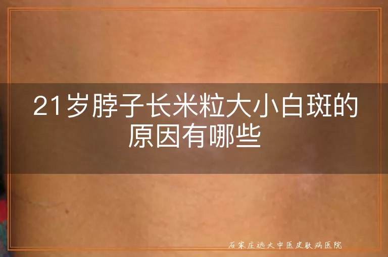 21岁脖子长米粒大小白斑的原因有哪些