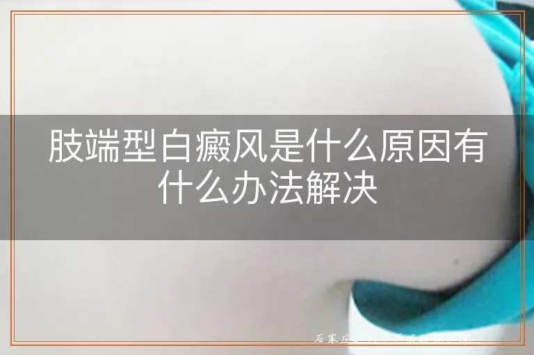 肢端型白癜风是什么原因有什么办法解决
