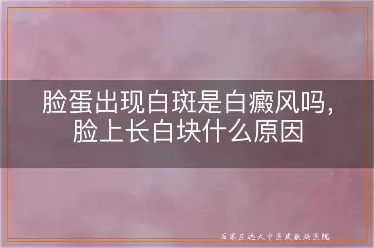脸蛋出现白斑是白癜风吗，脸上长白块什么原因