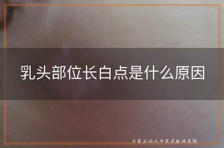 乳头部位长白点是什么原因
