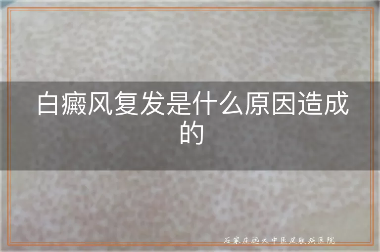 白癜风复发是什么原因造成的
