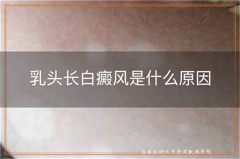 乳头长白癜风是什么原因