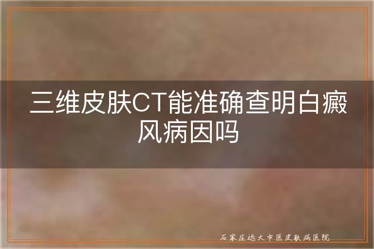 三维皮肤CT能准确查明白癜风病因吗