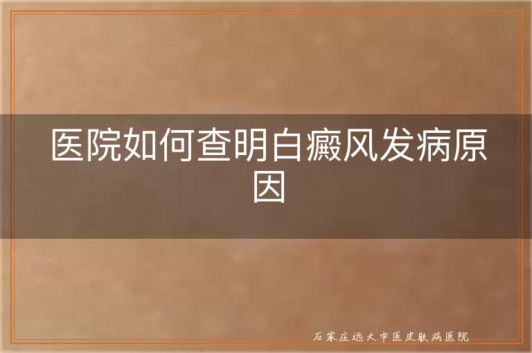 医院如何查明白癜风发病原因
