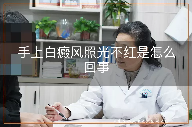 手上白癜风照光不红是怎么回事