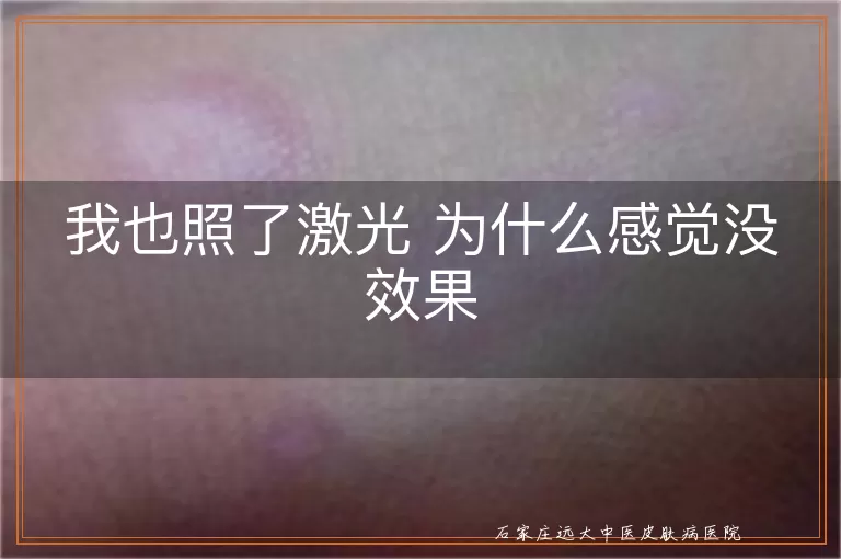 我也照了激光 为什么感觉没效果