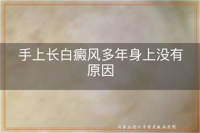 手上长白癜风多年身上没有原因