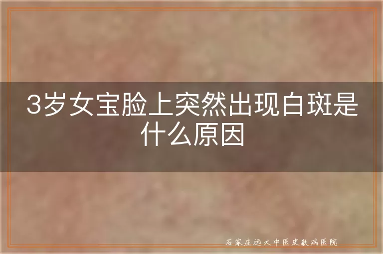 3岁女宝脸上突然出现白斑是什么原因