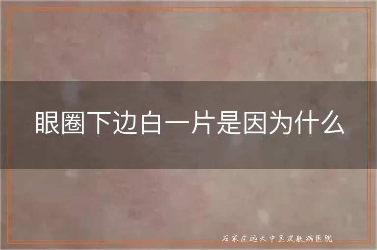 眼圈下边白一片是因为什么