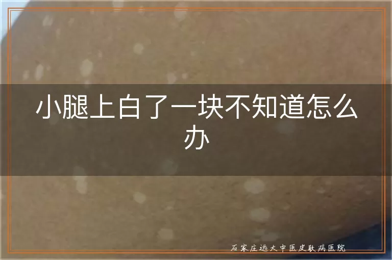 小腿上白了一块不知道怎么办
