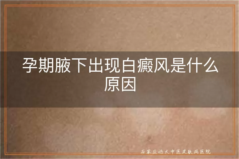 孕期腋下出现白癜风是什么原因