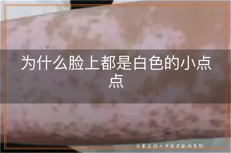为什么脸上都是白色的小点点