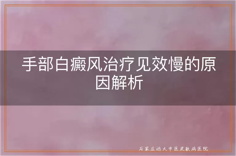 手部白癜风治疗见效慢的原因解析