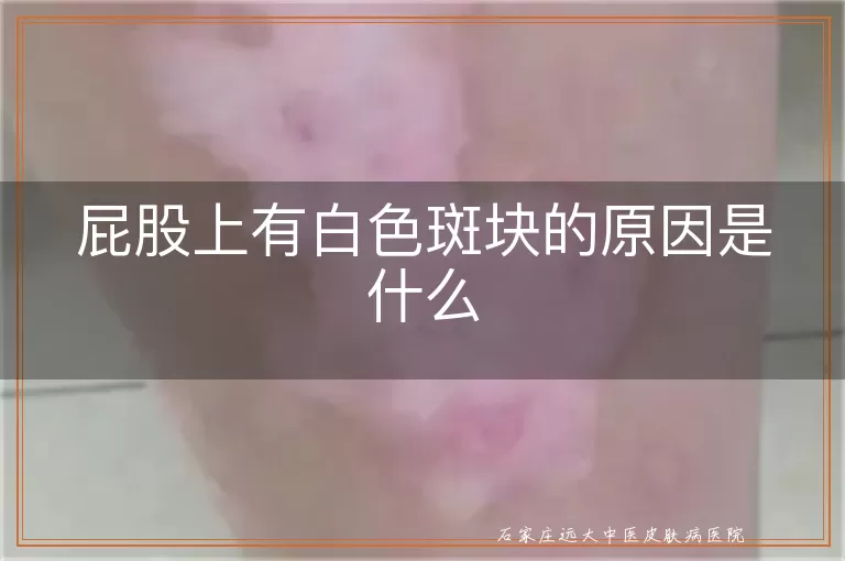 屁股上有白色斑块的原因是什么