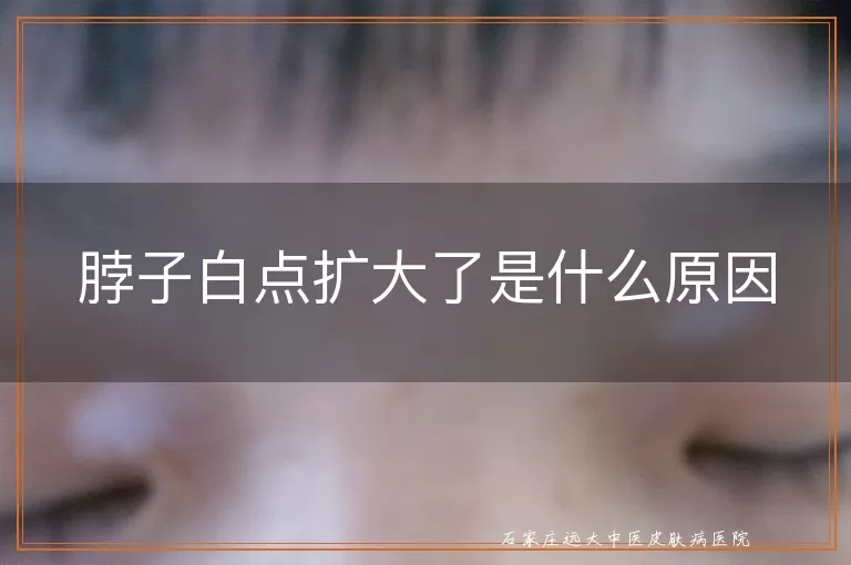 脖子白点扩大了是什么原因