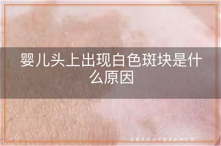 婴儿头上出现白色斑块是什么原因