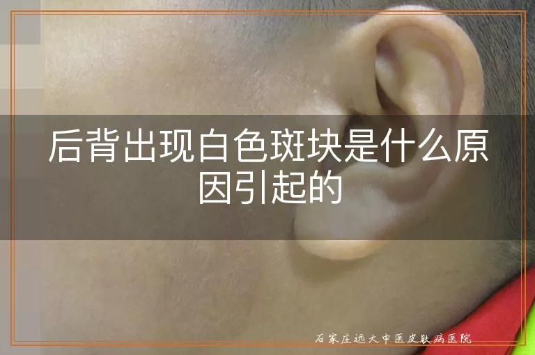 后背出现白色斑块是什么原因引起的
