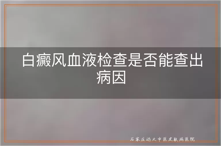 白癜风血液检查是否能查出病因