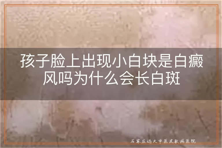 孩子脸上出现小白块是白癜风吗为什么会长白斑