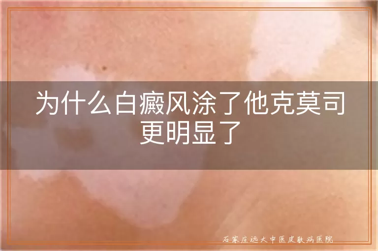 为什么白癜风涂了他克莫司更明显了