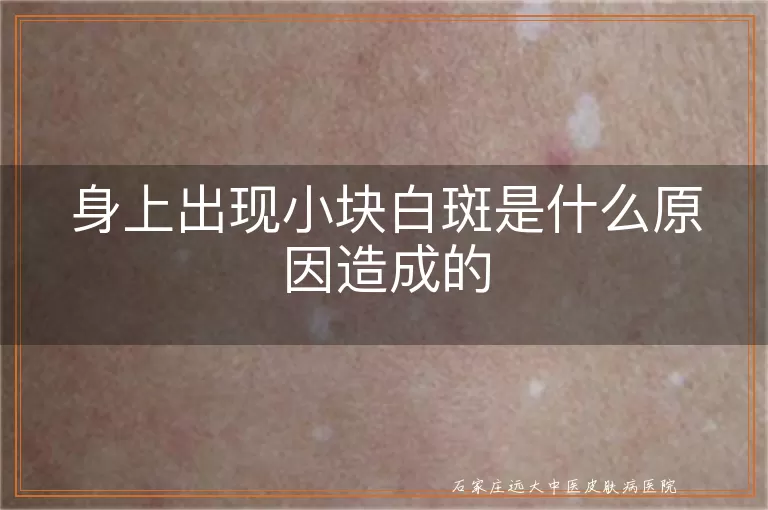 身上出现小块白斑是什么原因造成的