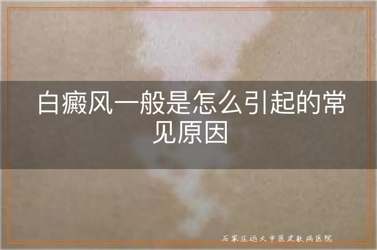 白癜风一般是怎么引起的常见原因