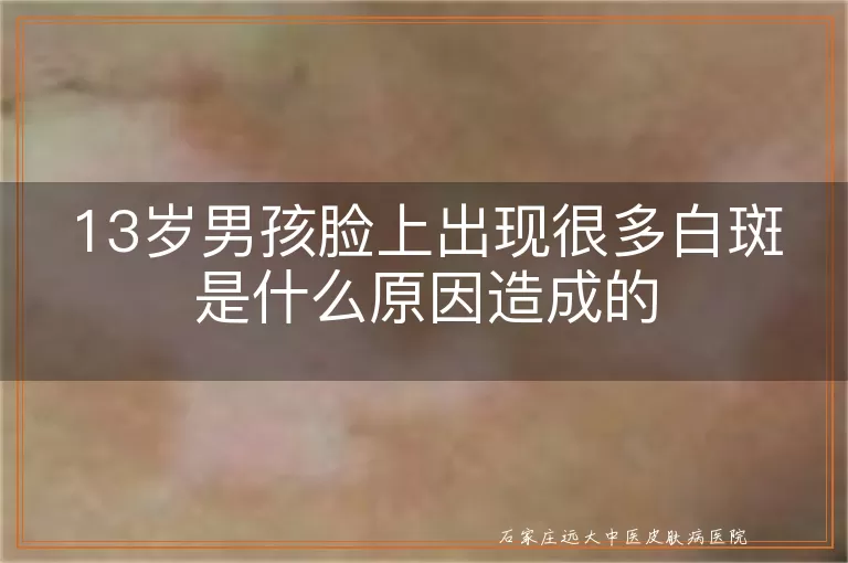 13岁男孩脸上出现很多白斑是什么原因造成的